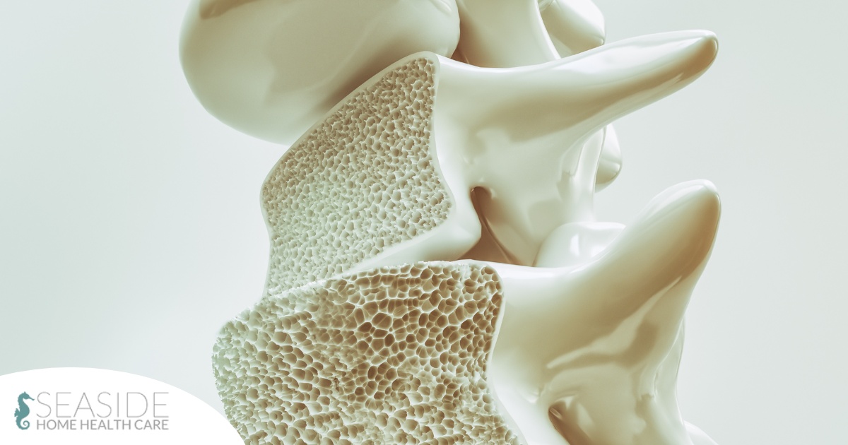 An image of a spine with the inside exposed represents osteoporosis.